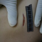 Autopsy of stabbed girl