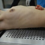 Autopsy of stabbed girl