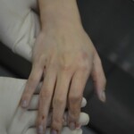 Autopsy of stabbed girl