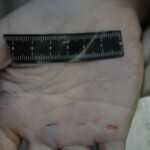 Autopsy of stabbed girl