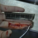 Autopsy of stabbed girl
