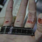 Autopsy of stabbed girl