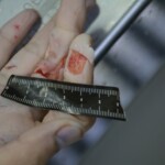 Autopsy of stabbed girl