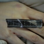 Autopsy of stabbed girl