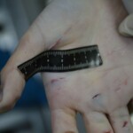 Autopsy of stabbed girl