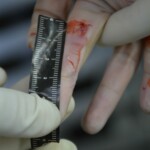 Autopsy of stabbed girl