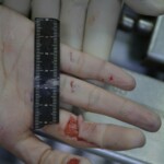 Autopsy of stabbed girl