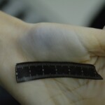 Autopsy of stabbed girl