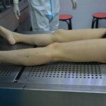 Autopsy of stabbed girl
