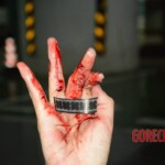 Stabbed teenage girl