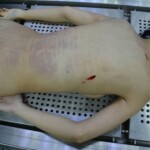 Autopsy of stabbed girl