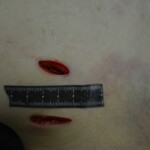 Autopsy of stabbed girl