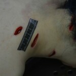 Autopsy of stabbed girl