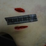 Autopsy of stabbed girl