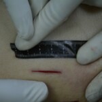 Autopsy of stabbed girl