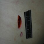 Autopsy of stabbed girl