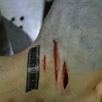 Autopsy of stabbed girl