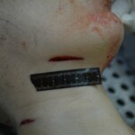 Autopsy of stabbed girl