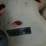 Autopsy of stabbed girl