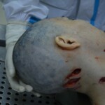 Autopsy of stabbed girl