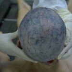 Autopsy of stabbed girl