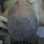 Autopsy of stabbed girl