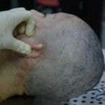 Autopsy of stabbed girl