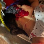 18-year-old girl accidentally died while sleeping in hammock