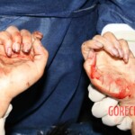 Autopsy of stabbed Chinese girl