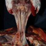 Autopsy of stabbed Chinese girl