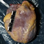 Autopsy of stabbed Chinese girl