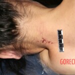 Autopsy of stabbed Chinese girl