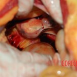 Autopsy of young woman stabbed to death