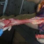 Autopsy of young woman stabbed to death