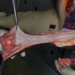 Autopsy of young woman stabbed to death