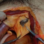 Autopsy of young woman stabbed to death