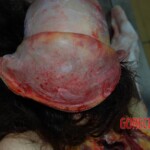 Autopsy of young woman stabbed to death