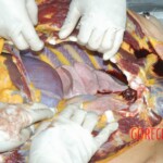 Autopsy of young girl
