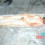 Autopsy of young girl