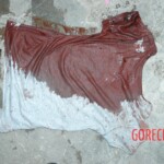 Autopsy of young girl