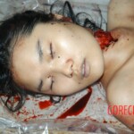 Autopsy of young girl