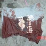 Autopsy of young girl