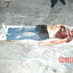 Autopsy of young girl