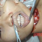 Autopsy of young girl