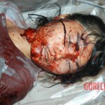 Autopsy of young girl