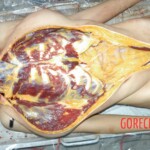 Autopsy of young girl