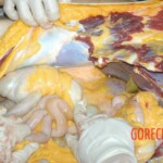 Autopsy of young girl