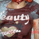 Autopsy of young girl