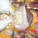 Autopsy of young girl