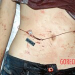 Autopsy of young girl